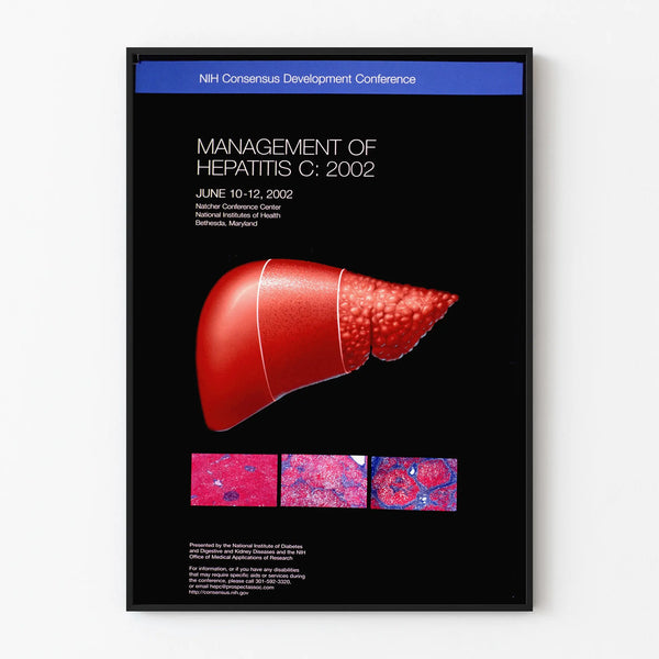 management-of-hepatitis-c