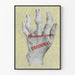 Poster vintage con mano deformata per reumatismi - Urodonal